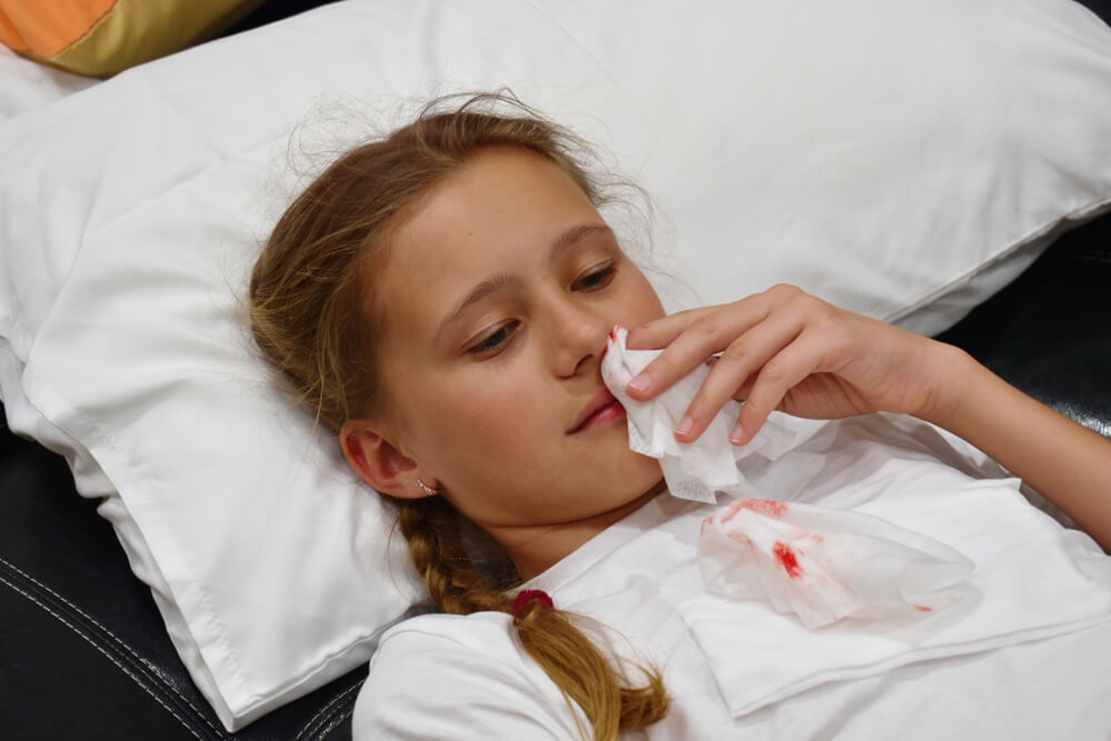 кровотечение из носа у детей