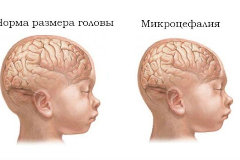 окружность головы ребенка в 2 года