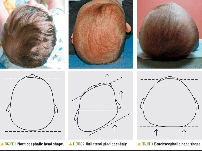 окружность головы ребенка по месяцам