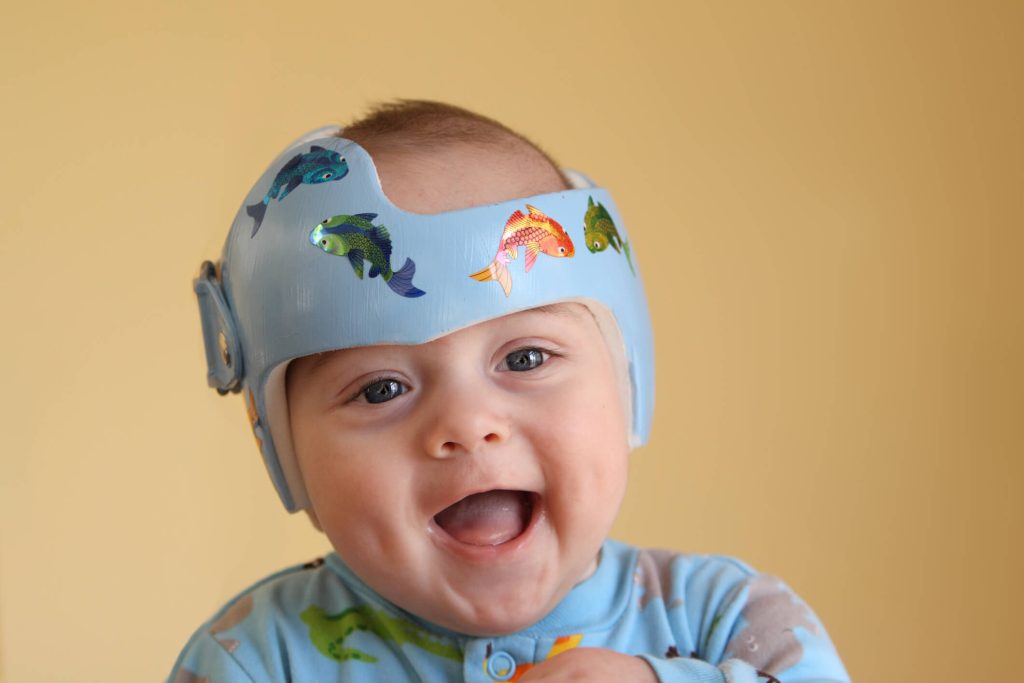 helmet for babies