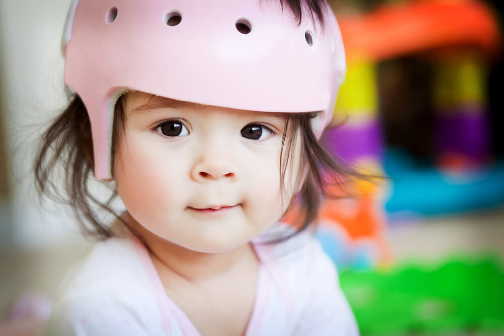 why do some babies wear helmets