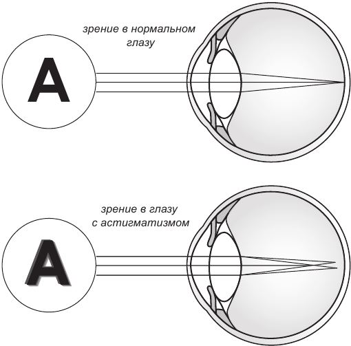 детский окулист